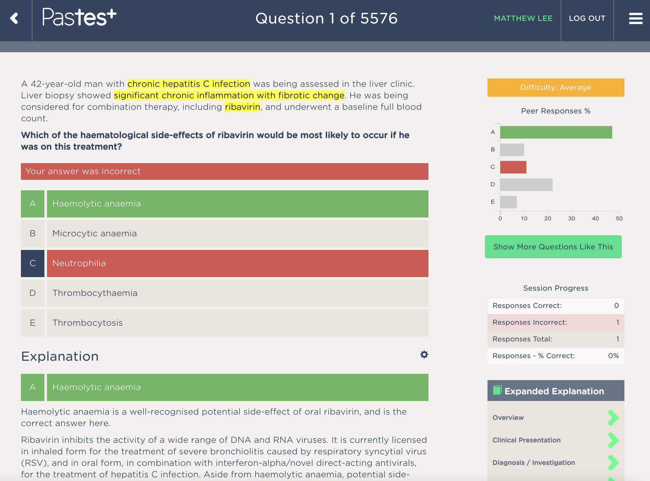 How I ranked top 10% in MRCP Part 1: Study Methods and Resources